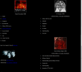 Discografía parcial de Evanescence