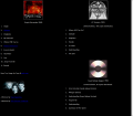 Evanescence discography page @ Bigwig, 2003